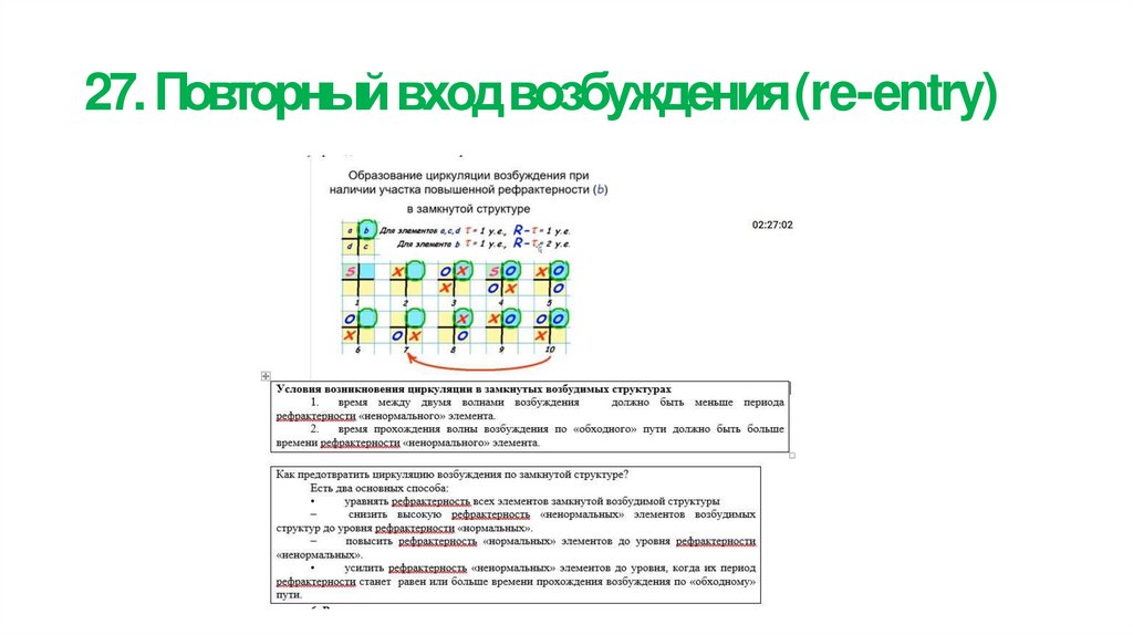 27. Повторный вход возбуждения (re-entry)