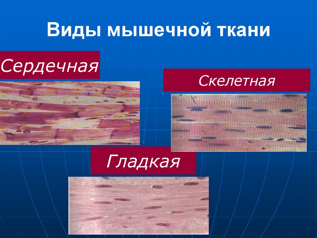 Виды мышечной ткани