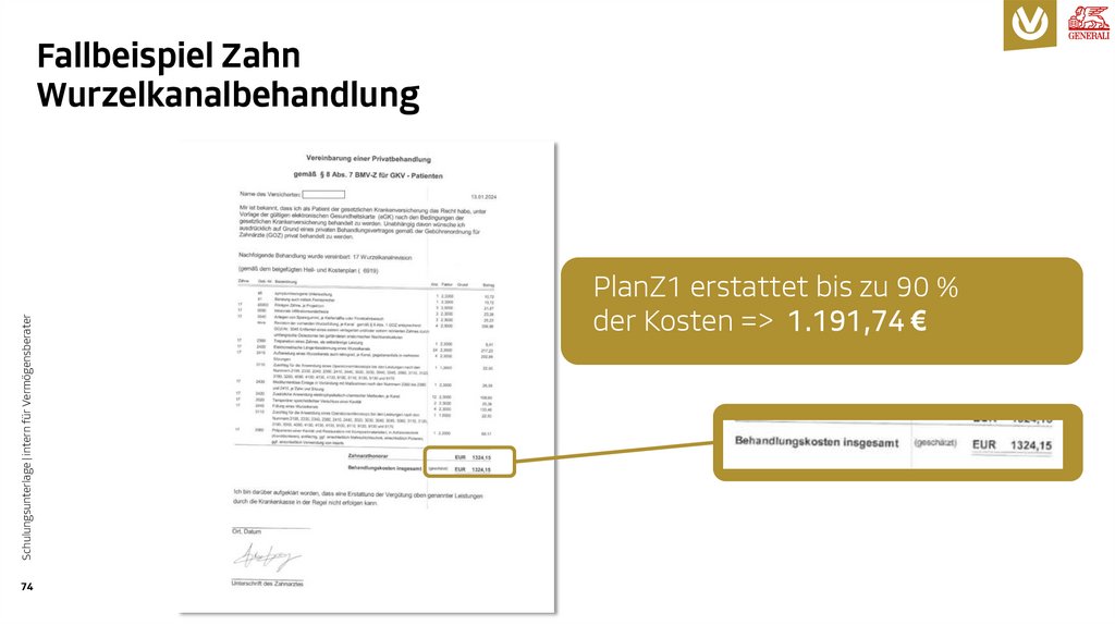 Fallbeispiel Zahn Wurzelkanalbehandlung