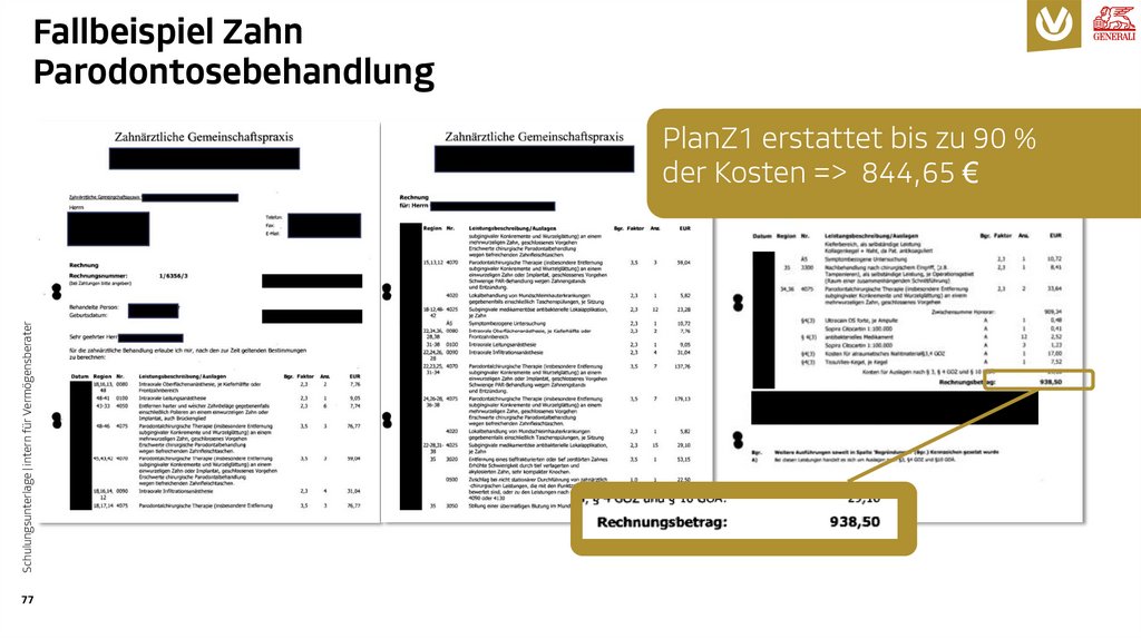 Fallbeispiel Zahn Parodontosebehandlung