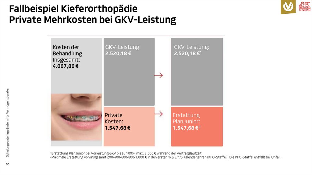 Fallbeispiel Kieferorthopädie Private Mehrkosten bei GKV-Leistung