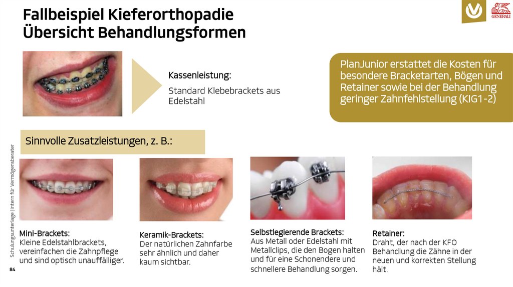 Fallbeispiel Kieferorthopadie Übersicht Behandlungsformen