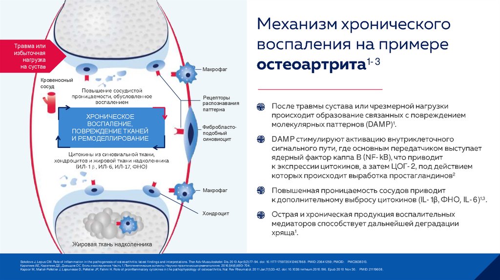 Механизм хронического воспаления на примере остеоартрита1-3