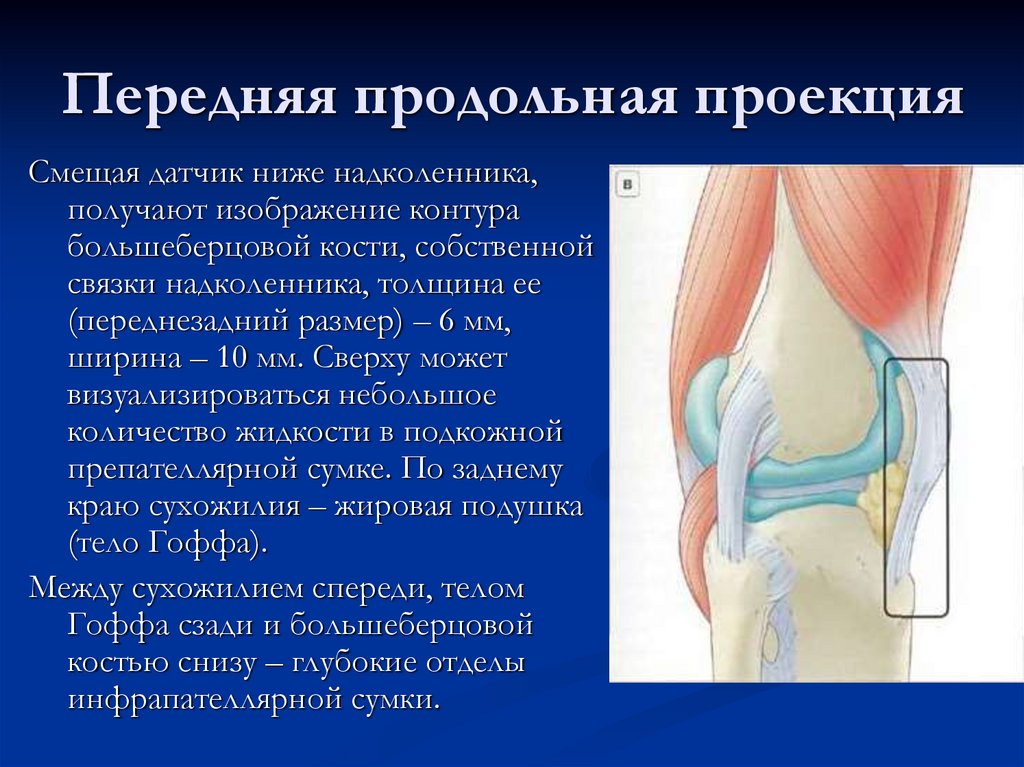 Передняя продольная проекция