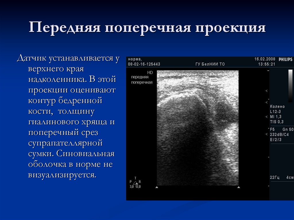 Передняя поперечная проекция