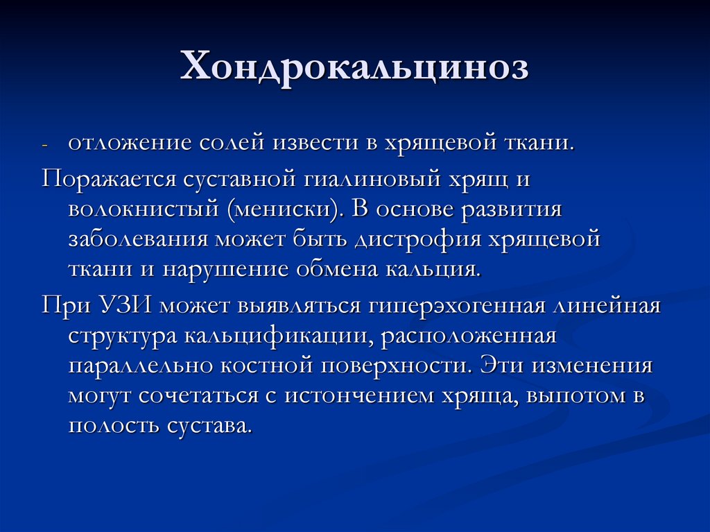 Хондрокальциноз