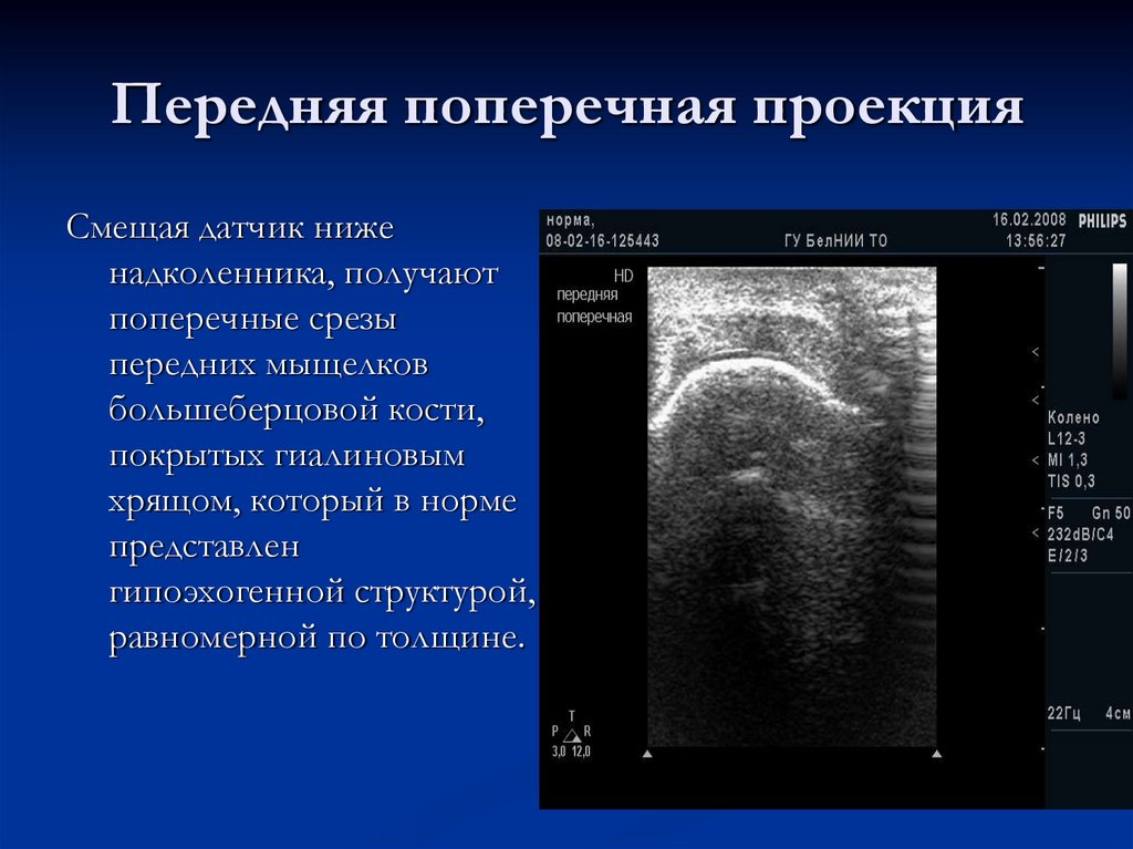 Передняя поперечная проекция
