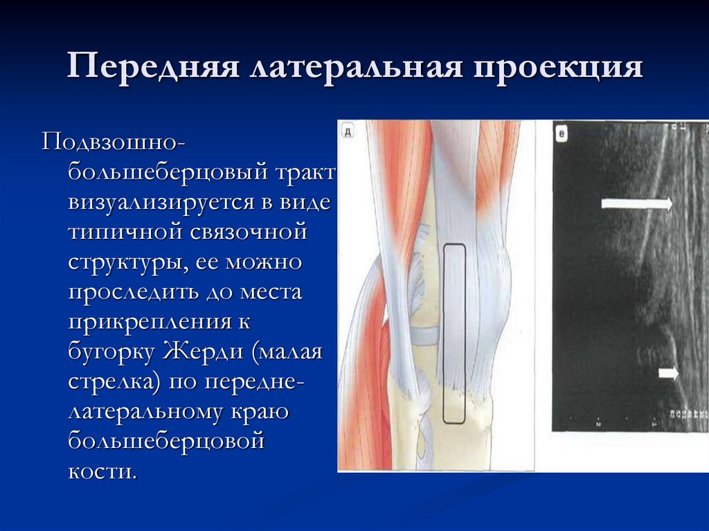 Передняя латеральная проекция