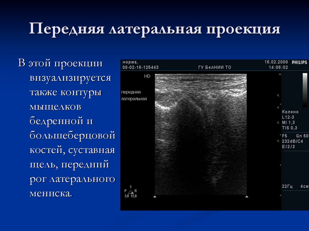 Передняя латеральная проекция