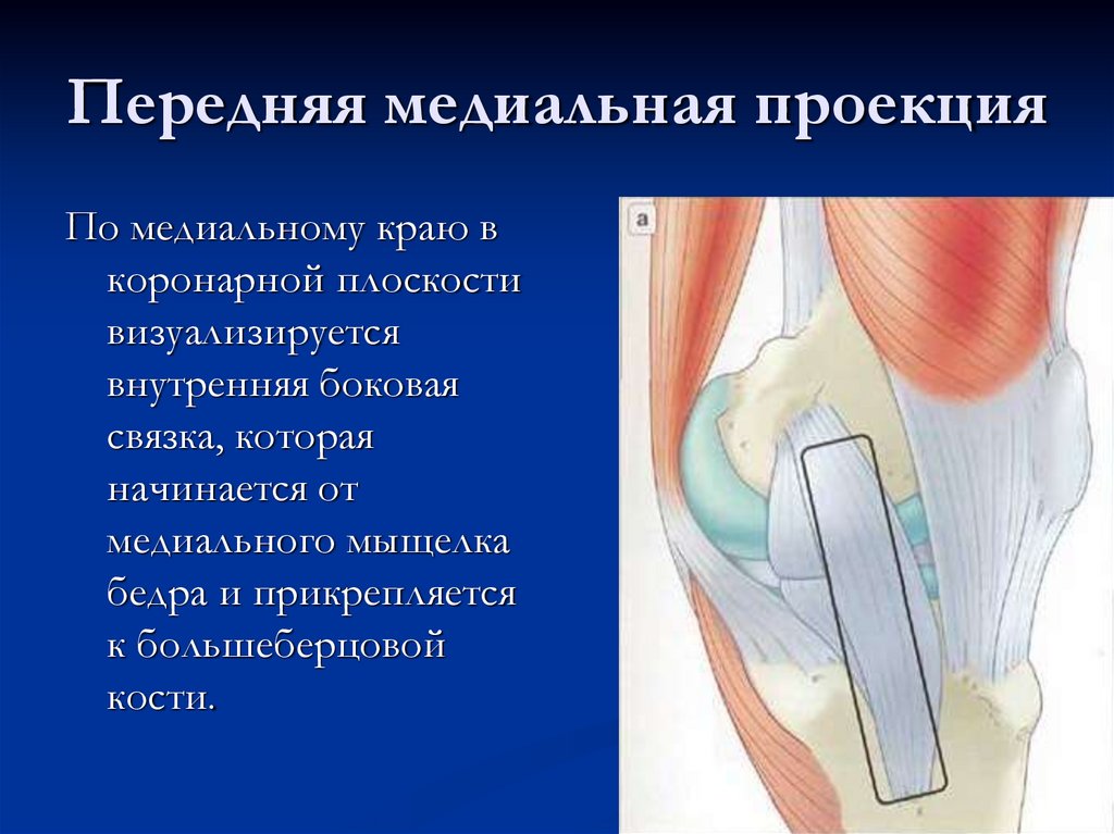 Передняя медиальная проекция