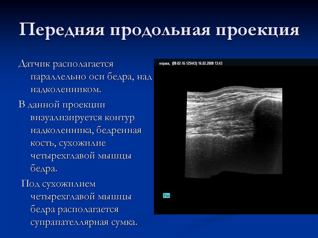 Передняя продольная проекция