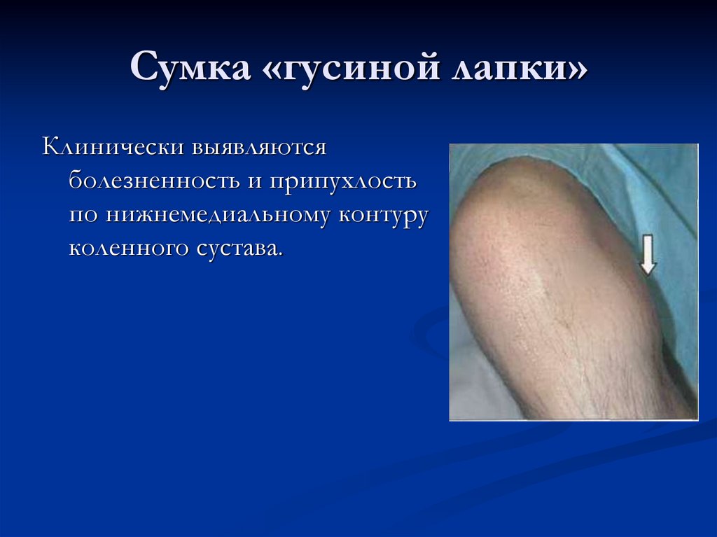 Сумка «гусиной лапки»