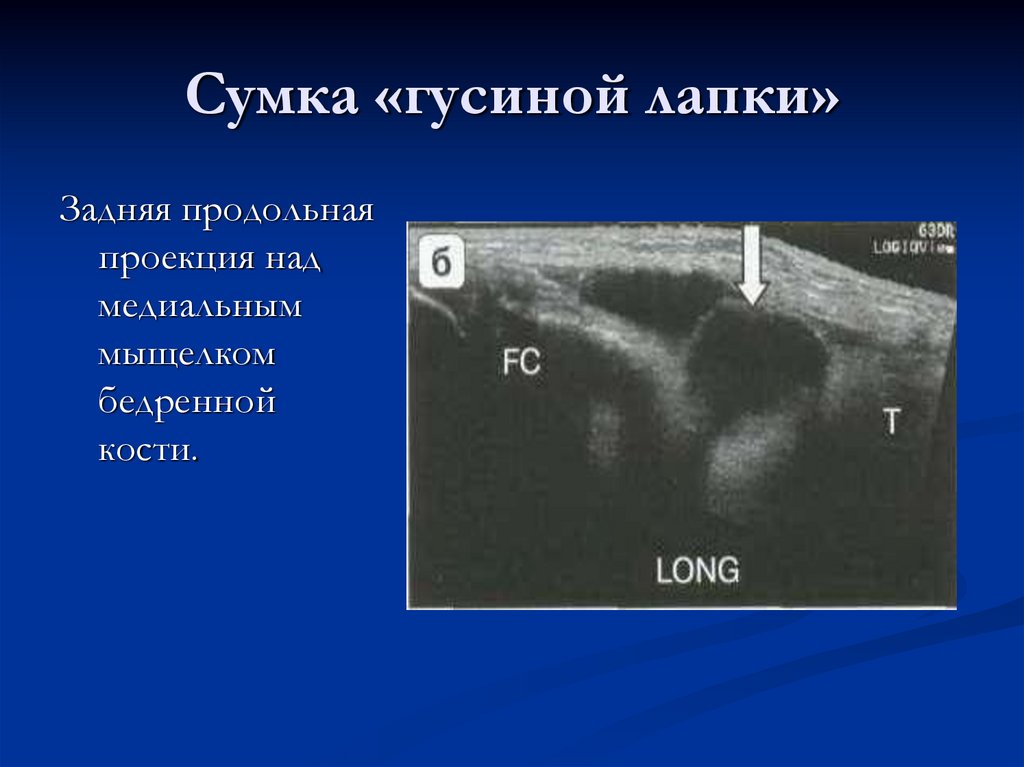 Сумка «гусиной лапки»