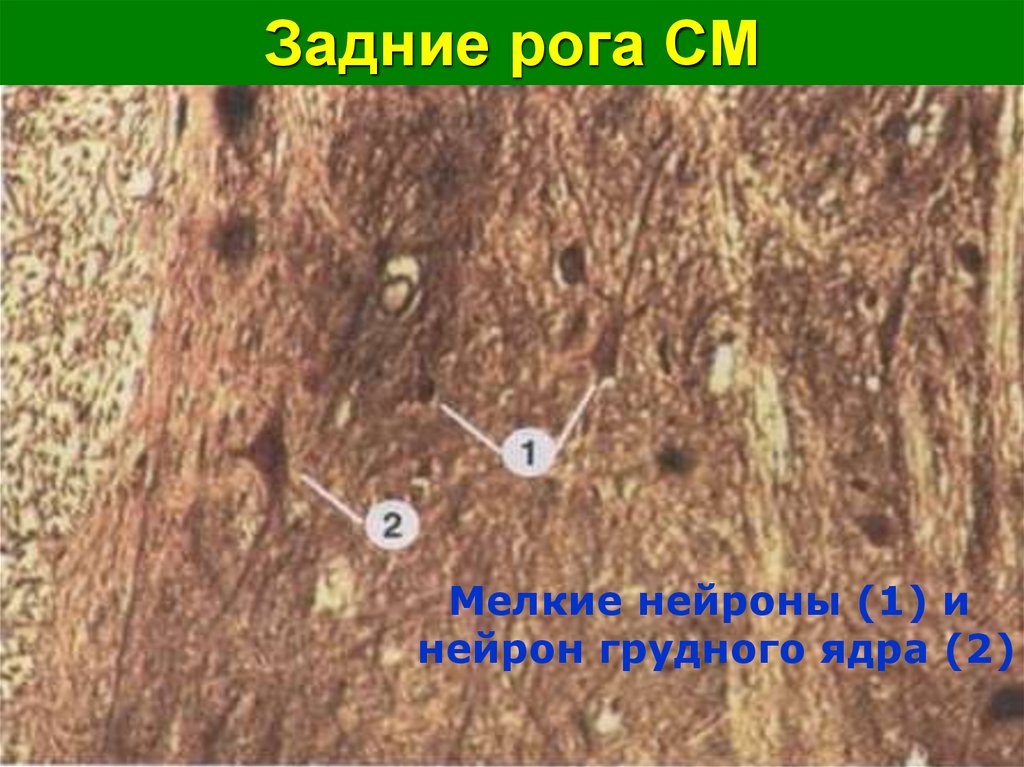 Задние рога СМ