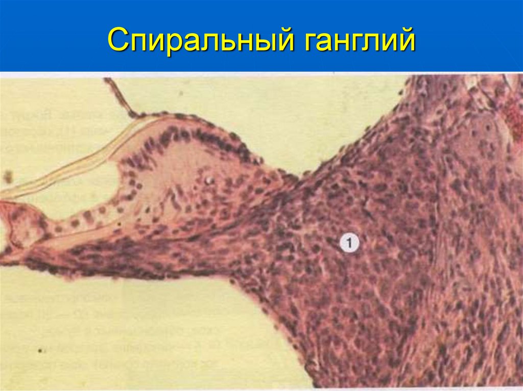 Спиральный ганглий