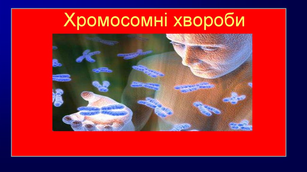 Хромосомні хвороби