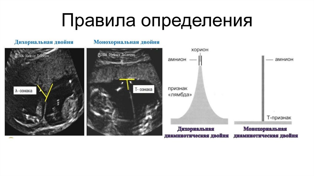 Правила определения
