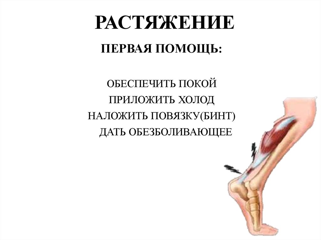 РАСТЯЖЕНИЕ