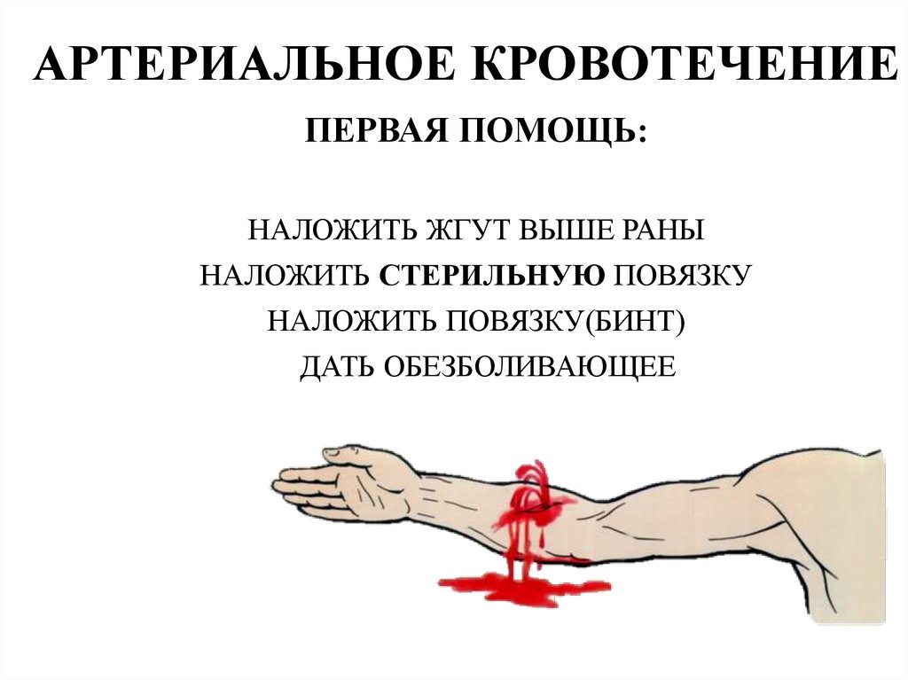 АРТЕРИАЛЬНОЕ КРОВОТЕЧЕНИЕ