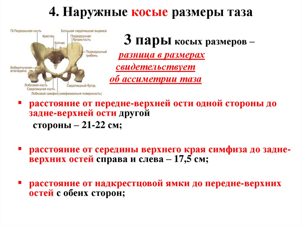 4. Наружные косые размеры таза