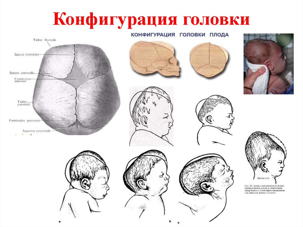 Конфигурация головки