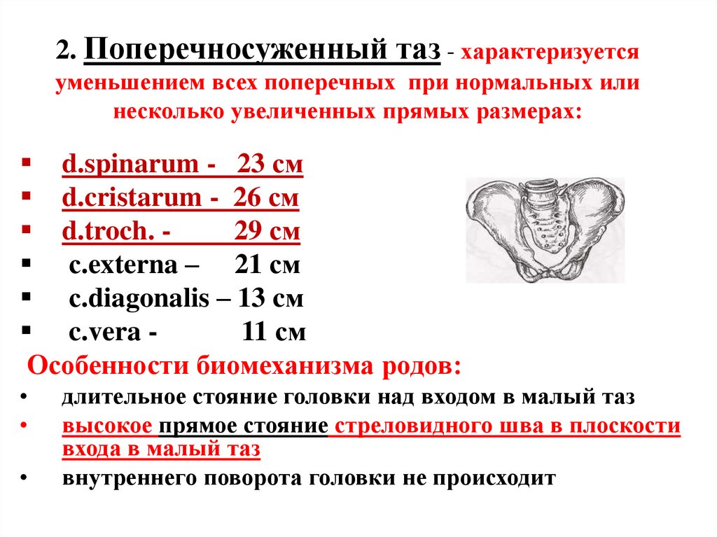 2. Поперечносуженный таз - характеризуется уменьшением всех поперечных при нормальных или несколько увеличенных прямых