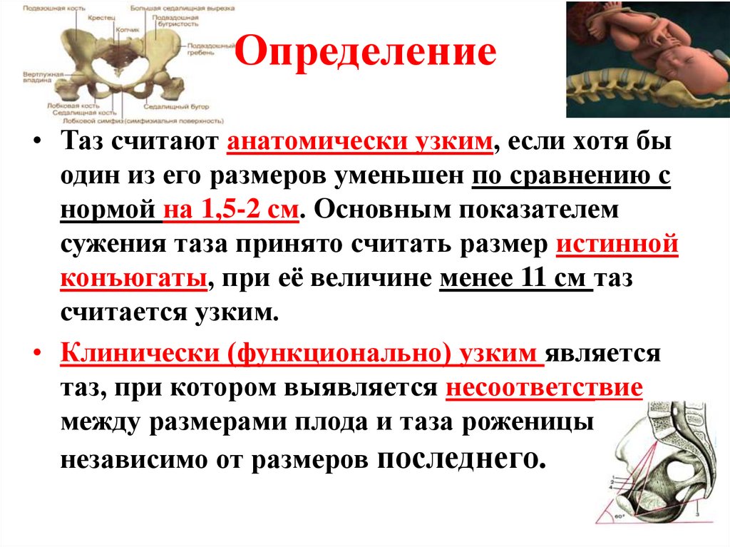 Определение