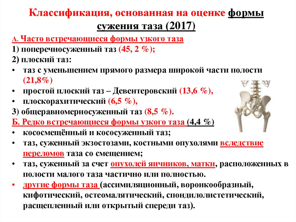 Классификация, основанная на оценке формы сужения таза (2017)