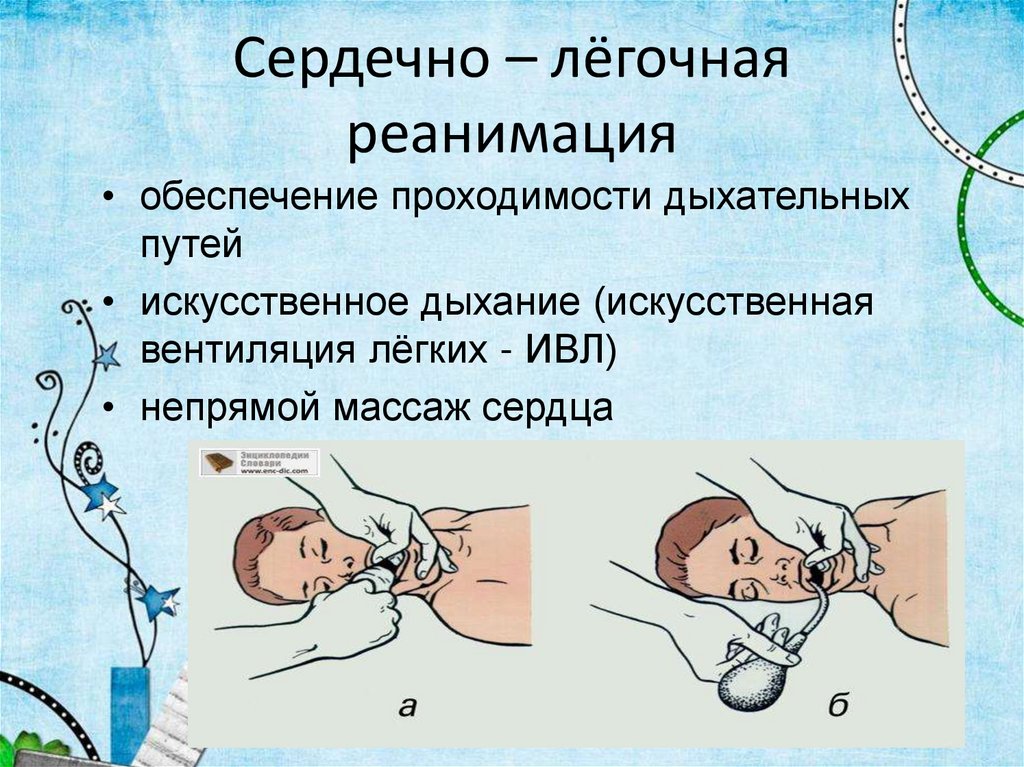 Сердечно – лёгочная реанимация