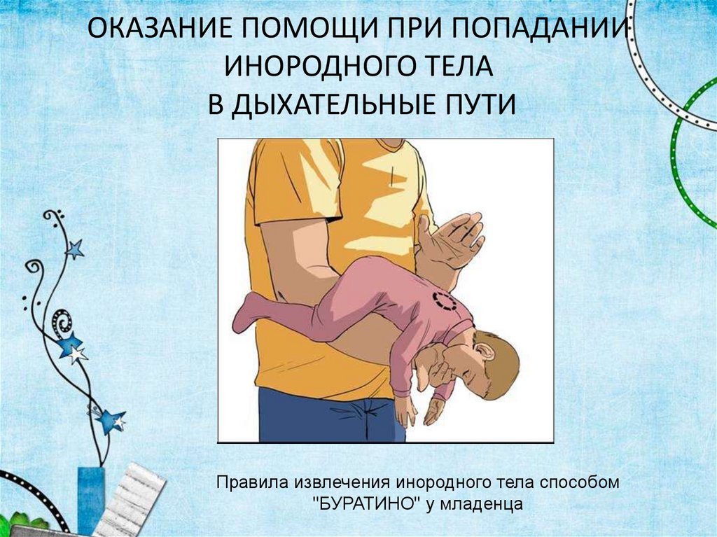 ОКАЗАНИЕ ПОМОЩИ ПРИ ПОПАДАНИИ ИНОРОДНОГО ТЕЛА В ДЫХАТЕЛЬНЫЕ ПУТИ