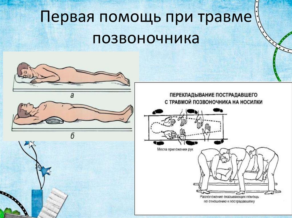 Первая помощь при травме позвоночника