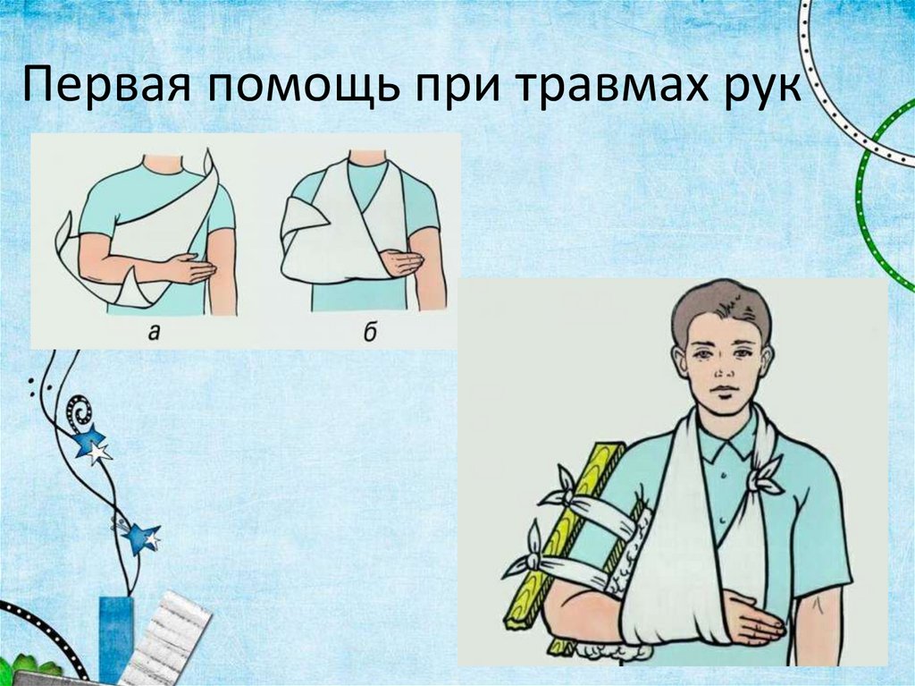 Первая помощь при травмах рук