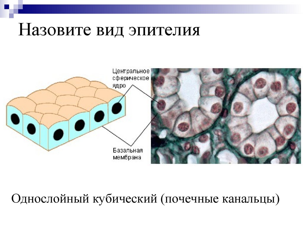 Назовите вид эпителия
