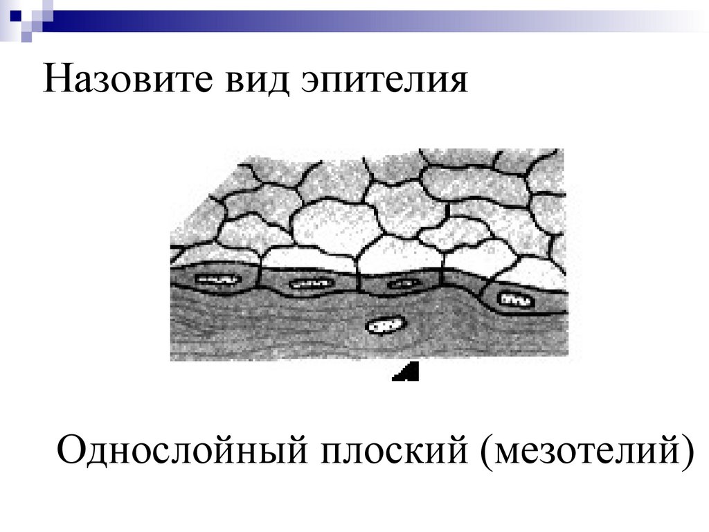 Назовите вид эпителия