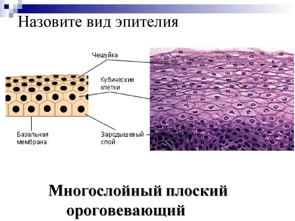Назовите вид эпителия