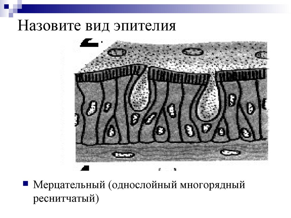 Назовите вид эпителия