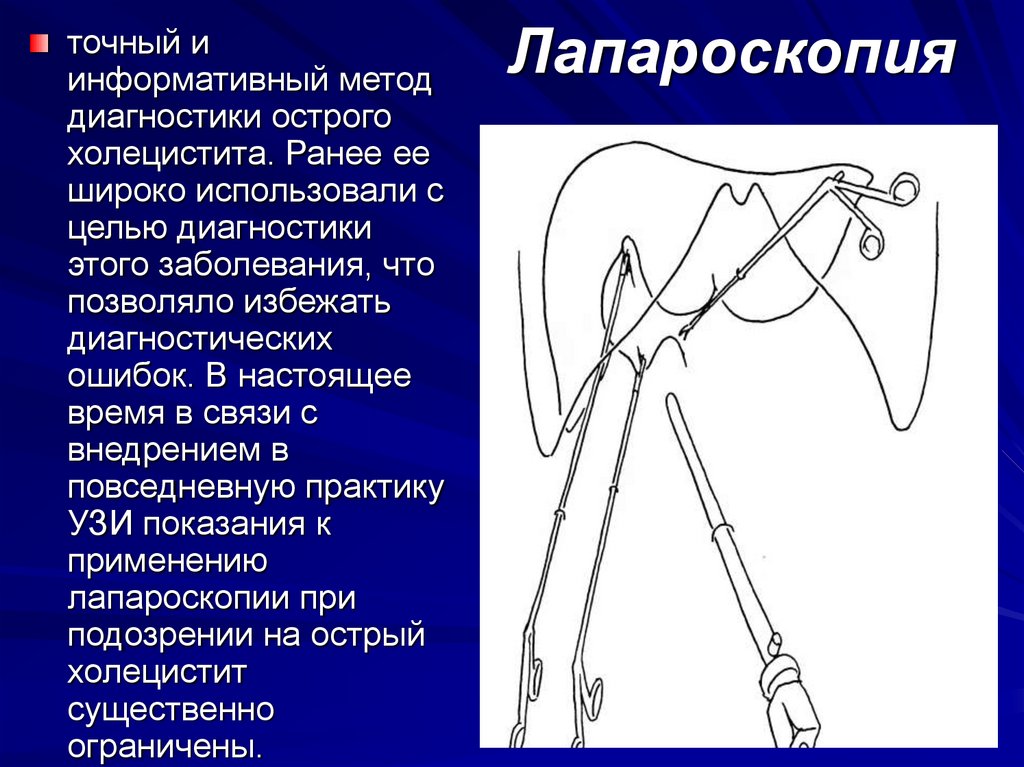 Лапароскопия