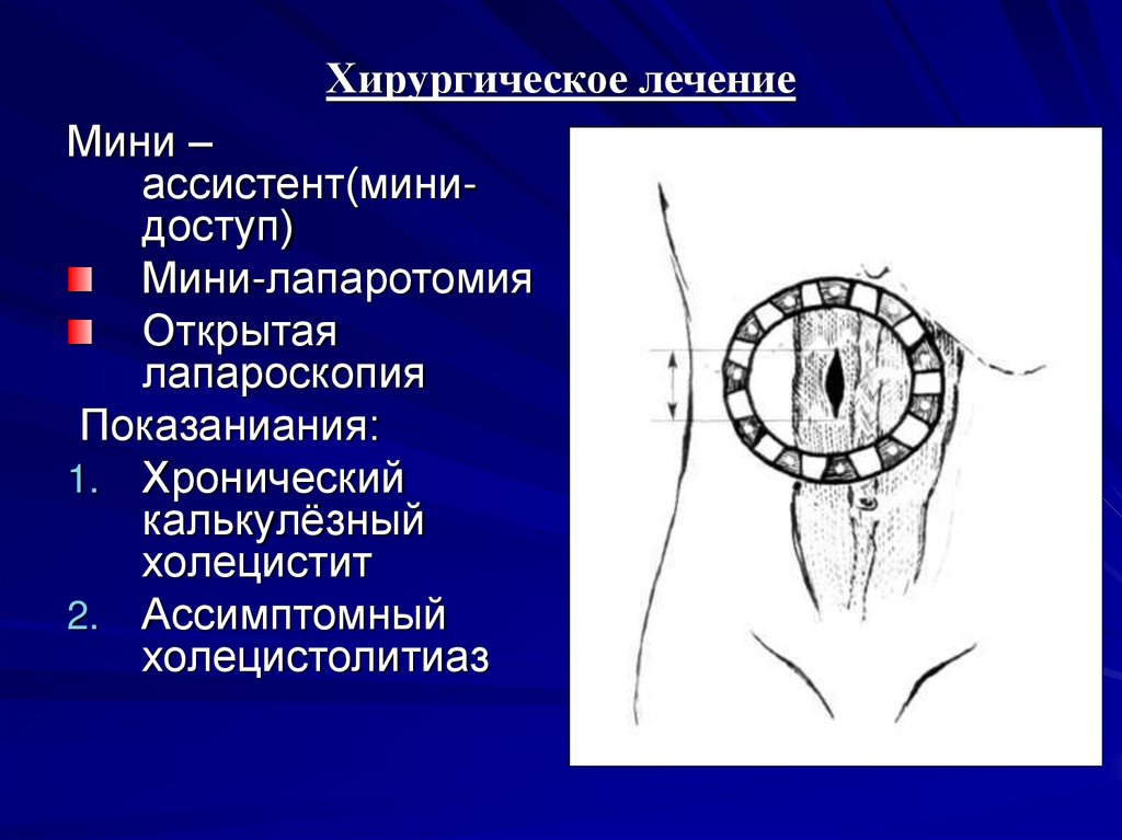 Хирургическое лечение