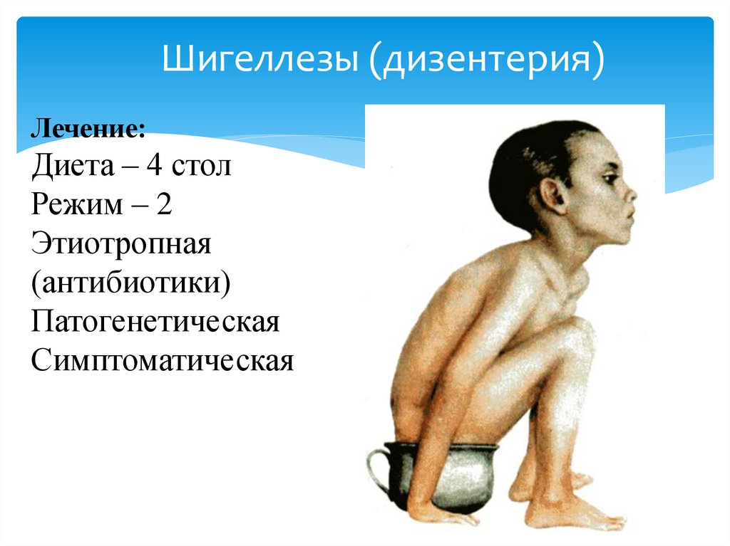 Шигеллезы (дизентерия)