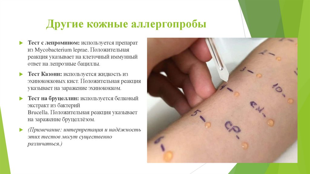 Другие кожные аллергопробы