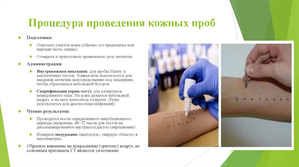 Процедура проведения кожных проб