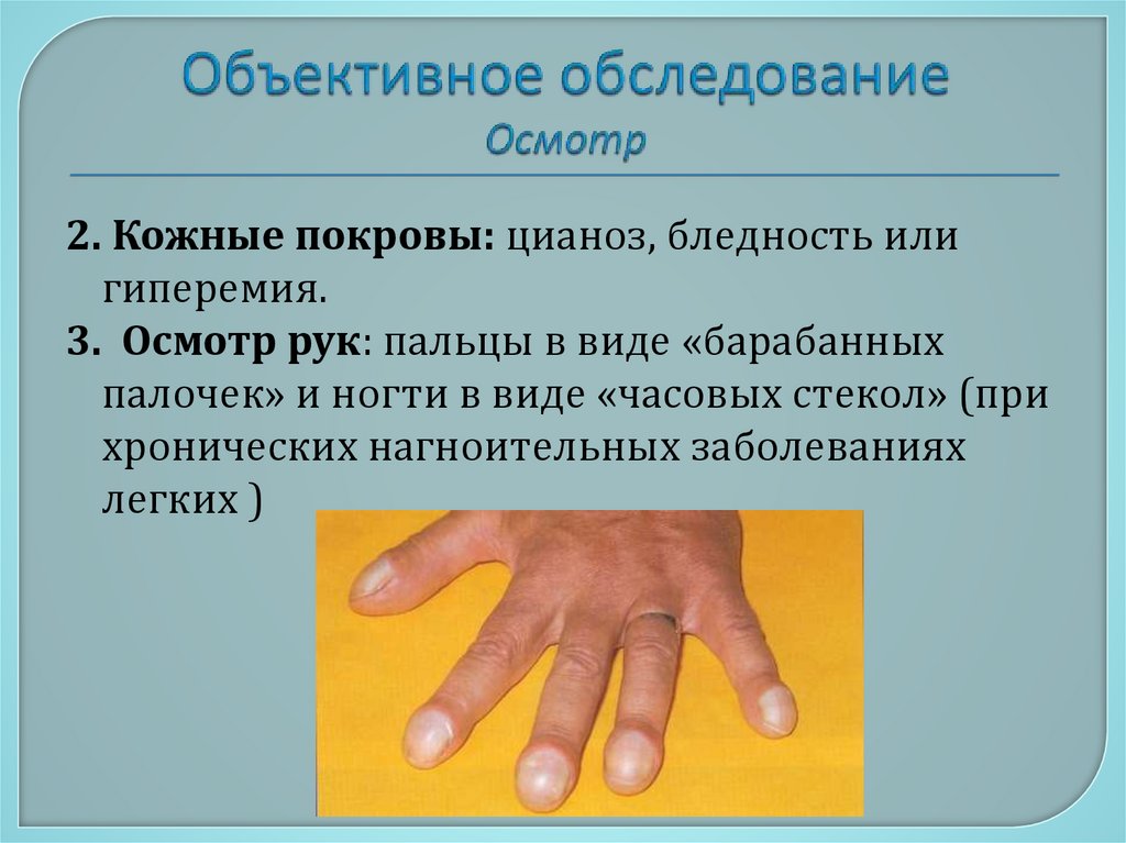 Объективное обследование Осмотр