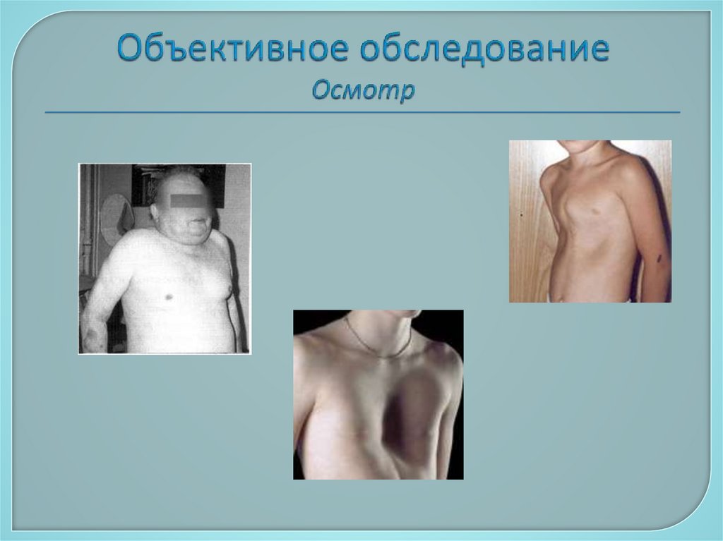 Объективное обследование Осмотр