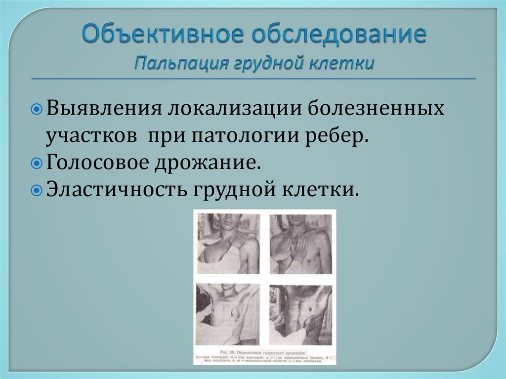 Объективное обследование Пальпация грудной клетки