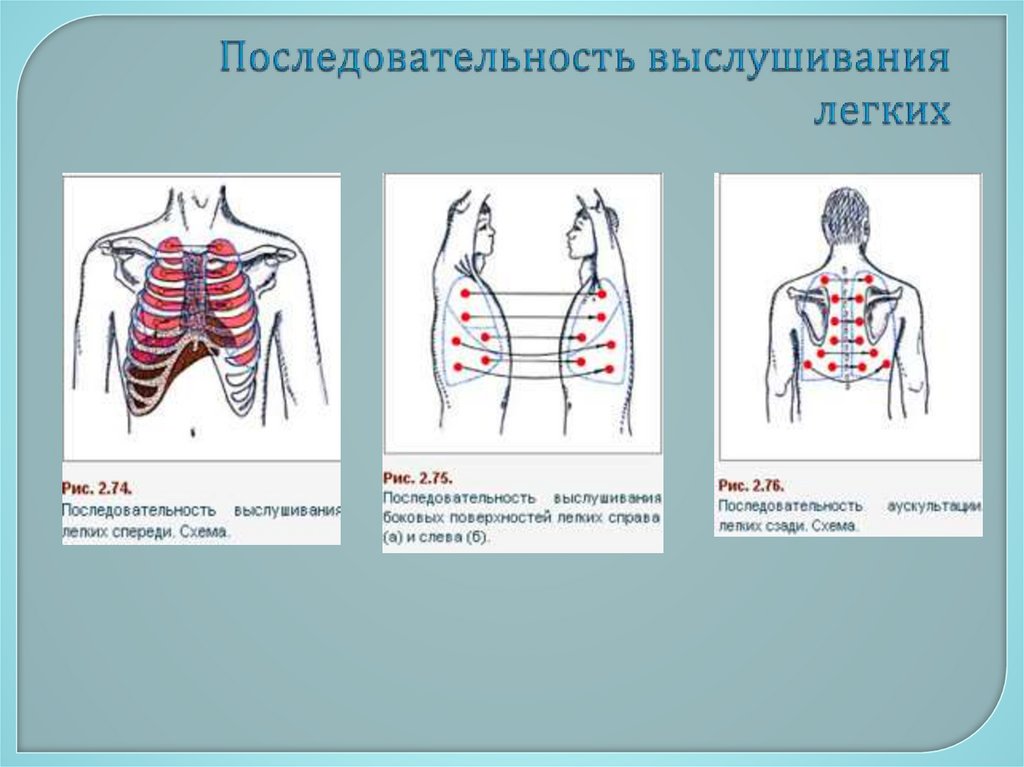 Последовательность выслушивания легких