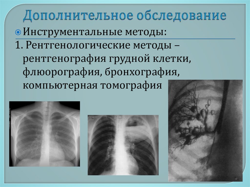 Дополнительное обследование