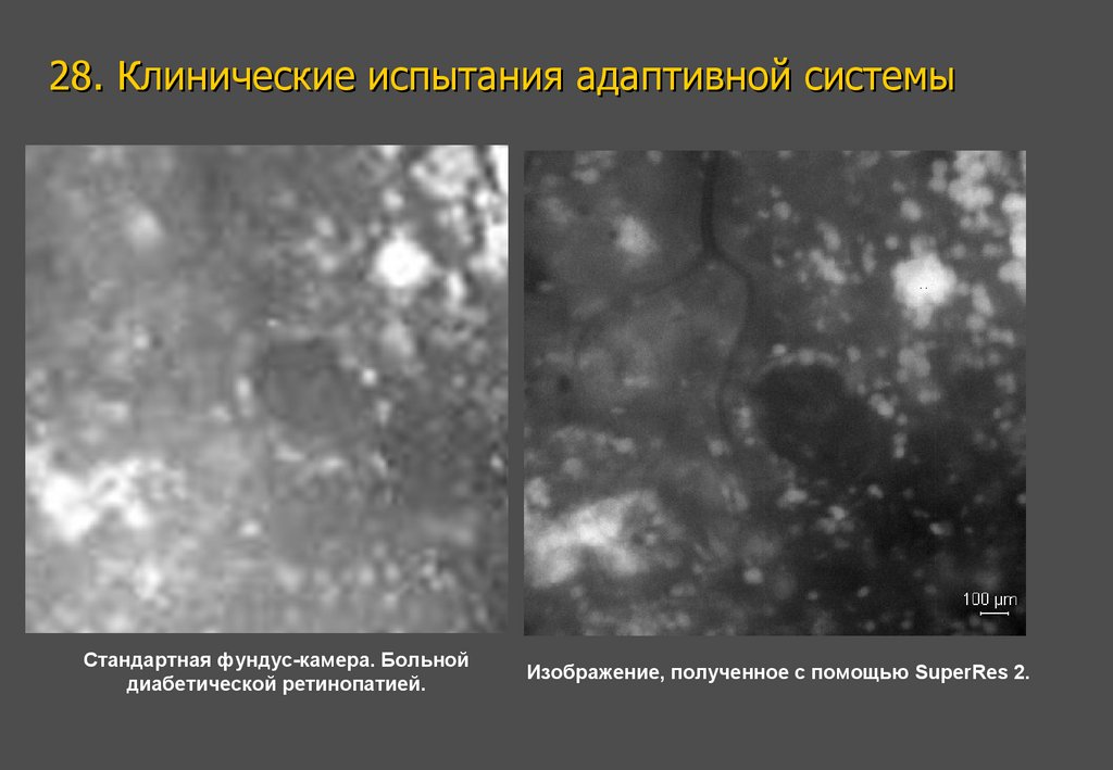 28. Клинические испытания адаптивной системы