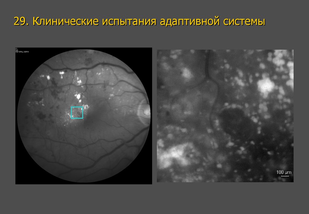 29. Клинические испытания адаптивной системы