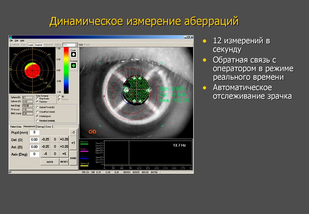 Динамическое измерение аберраций