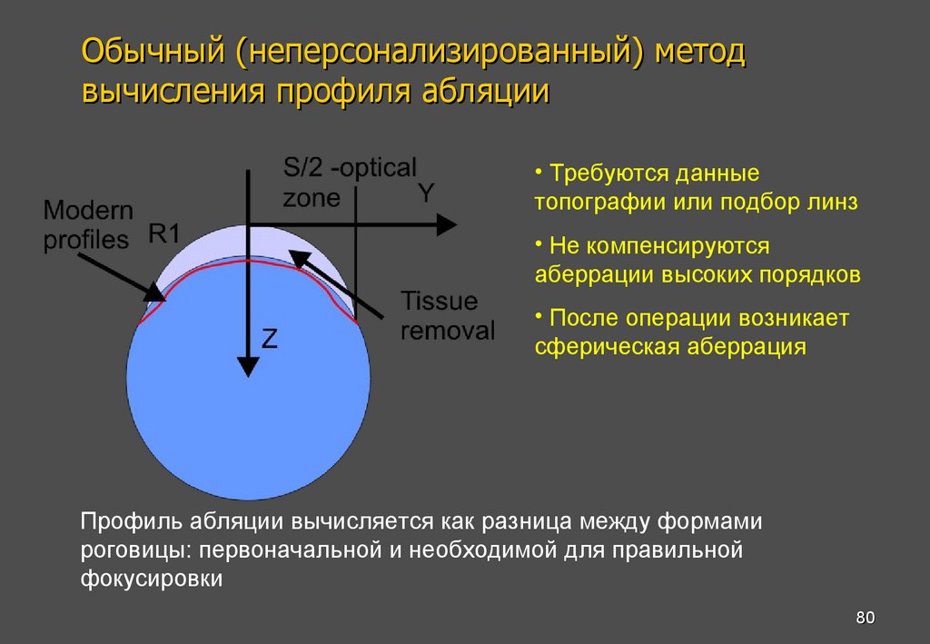 Обычный (неперсонализированный) метод вычисления профиля абляции